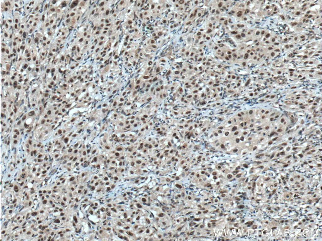 CHD4 antibody (66222-1-Ig) | Proteintech