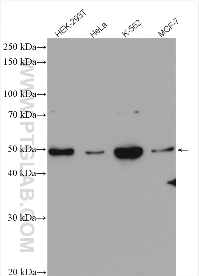 Chk1 antibody (25887-1-AP) | Proteintech