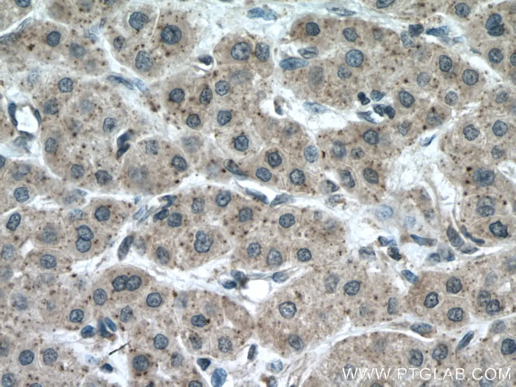 CHMP2A antibody (10477-1-AP) | Proteintech