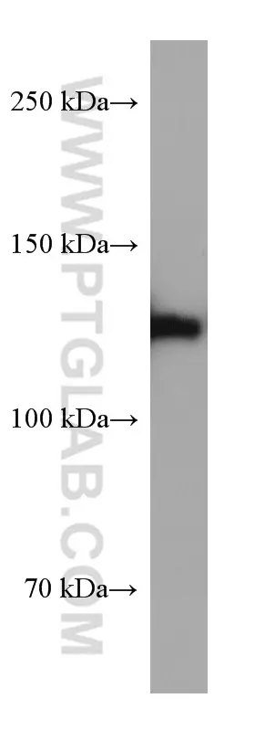 CLIP-115/CLIP2 antibody (67776-1-Ig) Proteintech