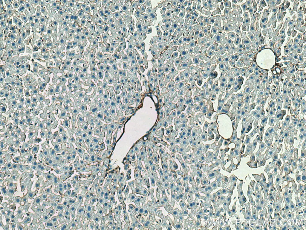 Immunohistochemical analysis of paraffin-embedded mouse liver tissue slide using Collagen Type III (N-terminal) antibody