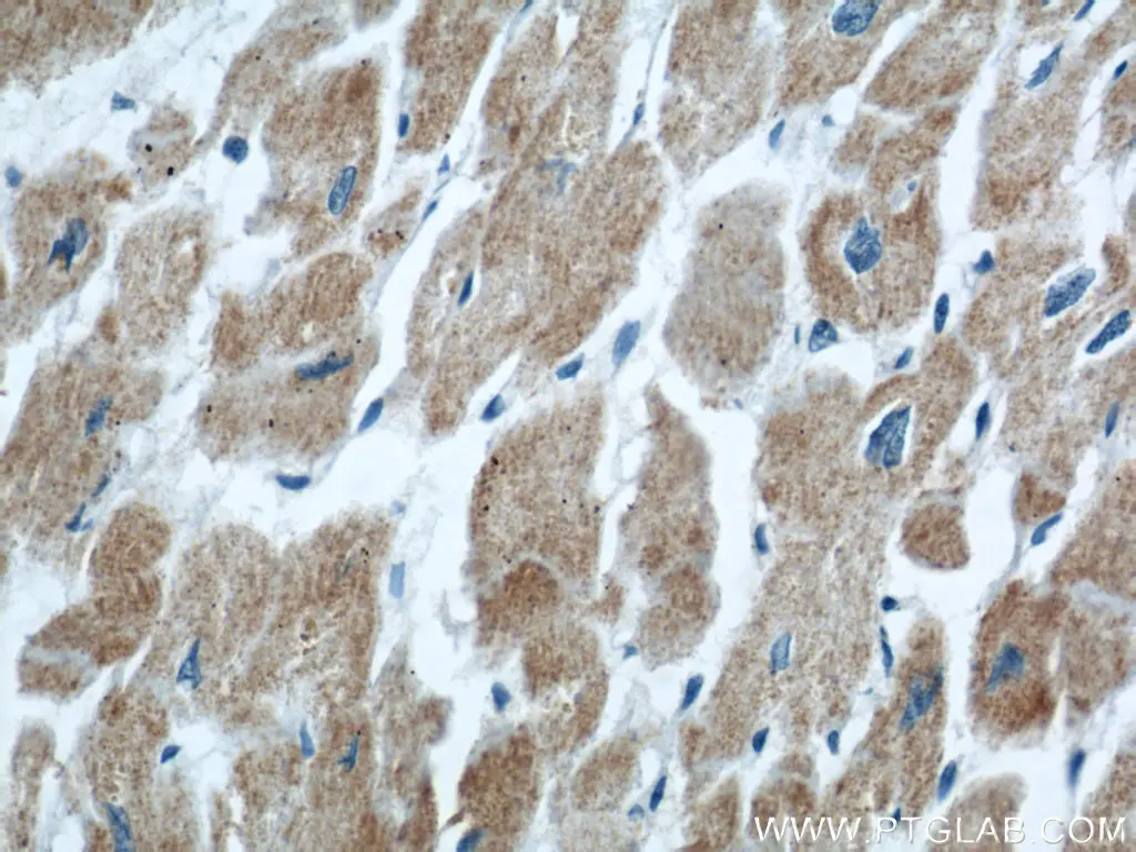 COXIV antibody (11242-1-AP) | Proteintech