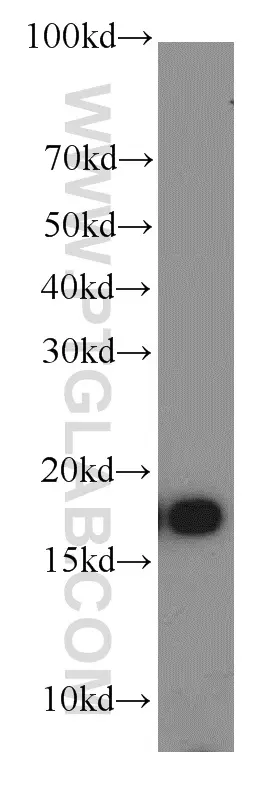 COX4I2 antibody (11463-1-AP) | Proteintech