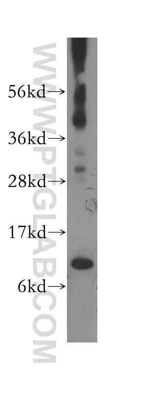 COX7A1 antibody (11413-1-AP) | Proteintech