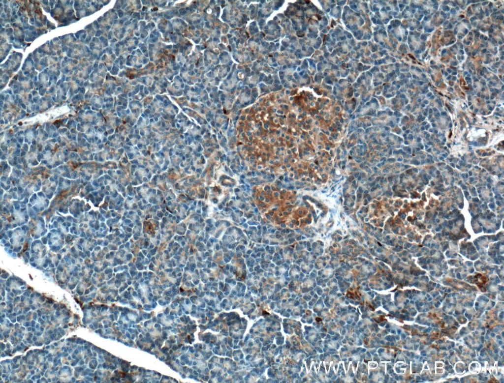 Immunohistochemistry of paraffin-embedded human pancreas tissue slide using 12315-1-AP CRB3 Antibody