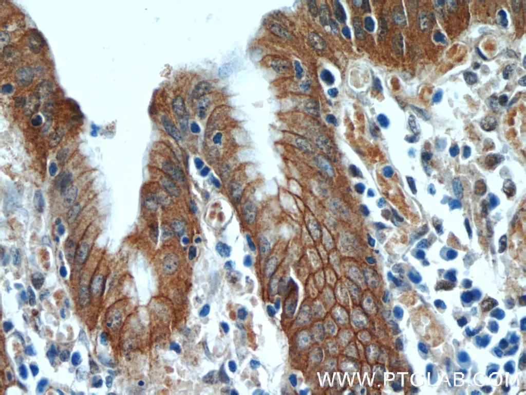 Figure 1. Immunohistochemistry of paraffin-embedded human stomach tissue slide using Alpha E catenin antibody