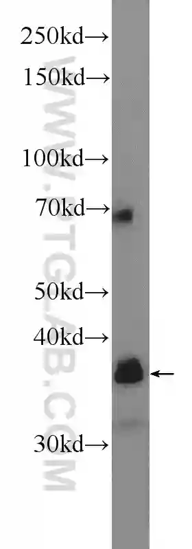 CTSZ antibody (16578-1-AP) | Proteintech