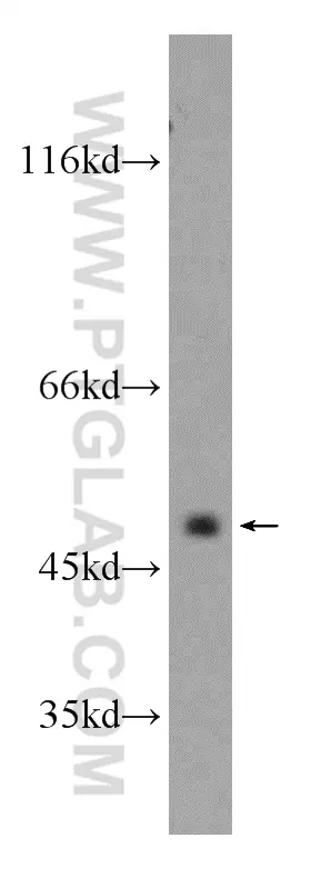 CXCR7 antibody (20423-1-AP) | Proteintech