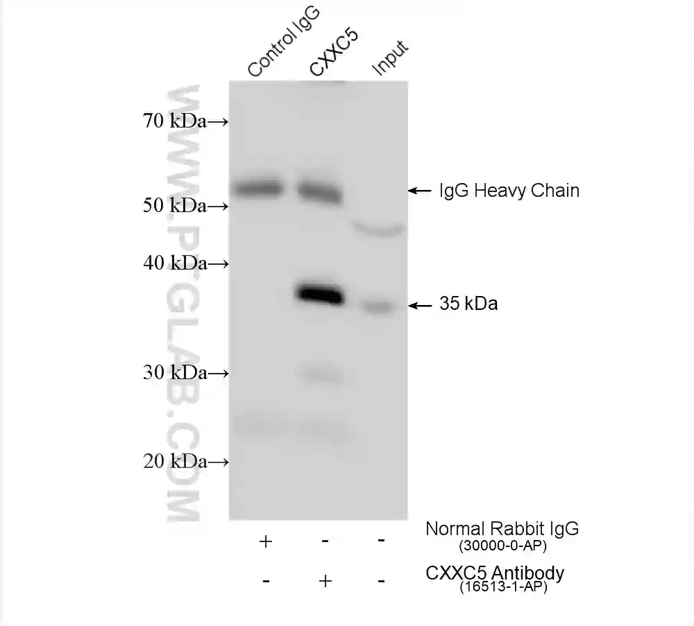 CXXC5 antibody (16513-1-AP) | Proteintech