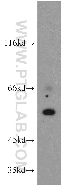CYP24A1 antibody (21582-1-AP) | Proteintech
