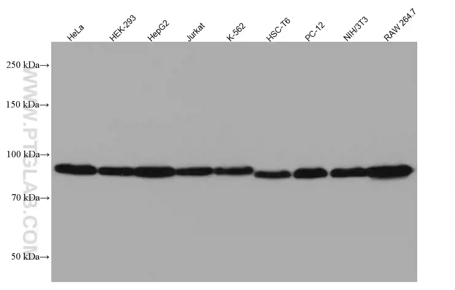 Calnexin antibody (66903-1-Ig) | Proteintech