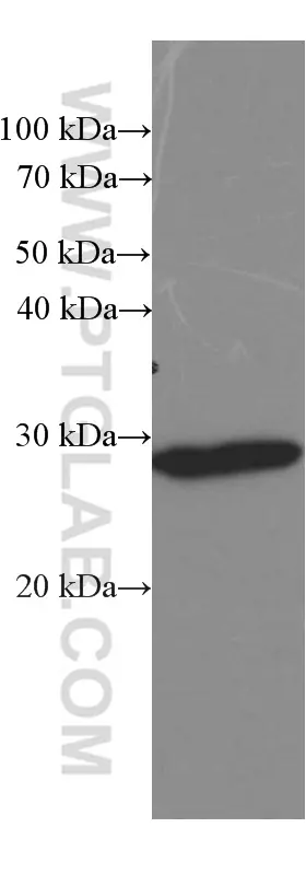 Calretinin antibody (66496-1-Ig) | Proteintech