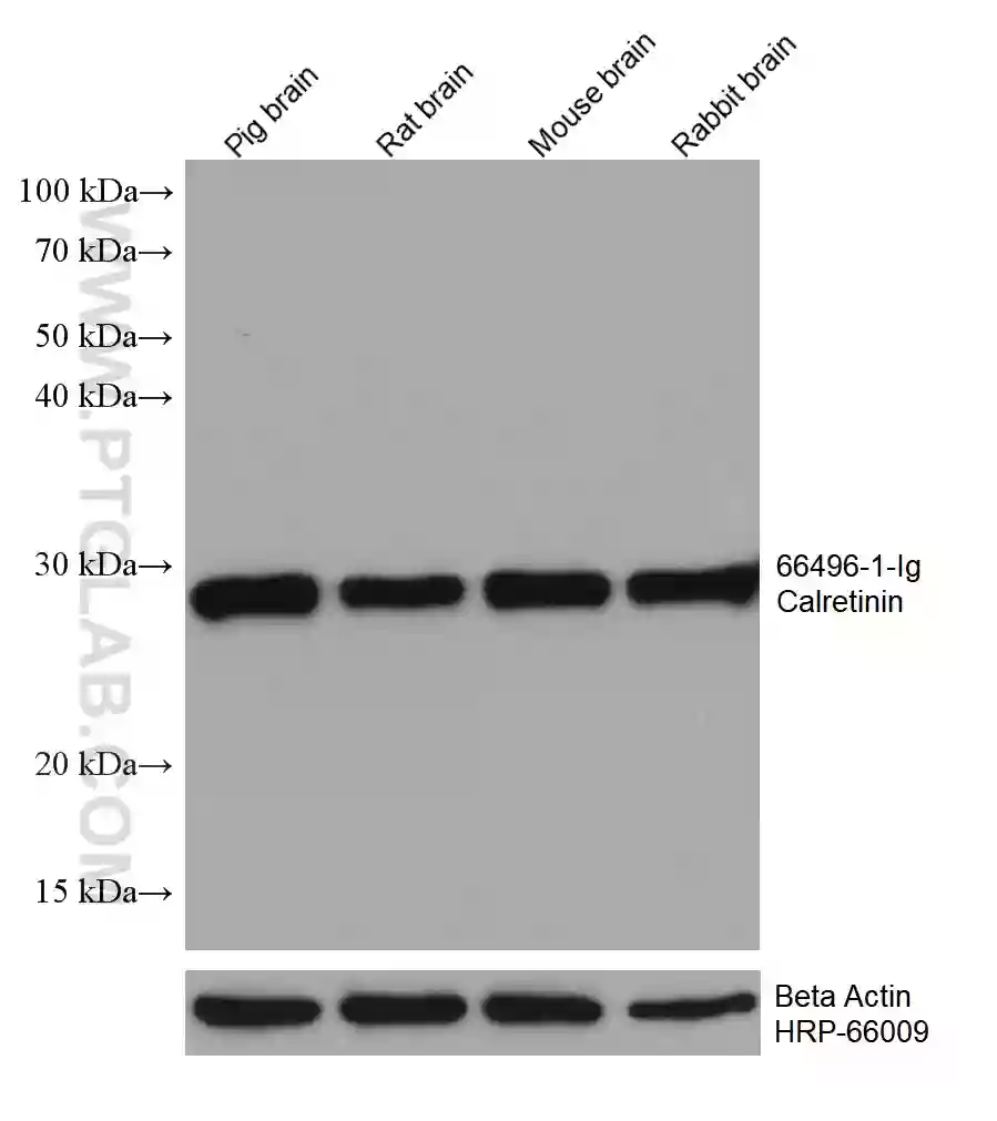 Calretinin antibody (66496-1-Ig) | Proteintech