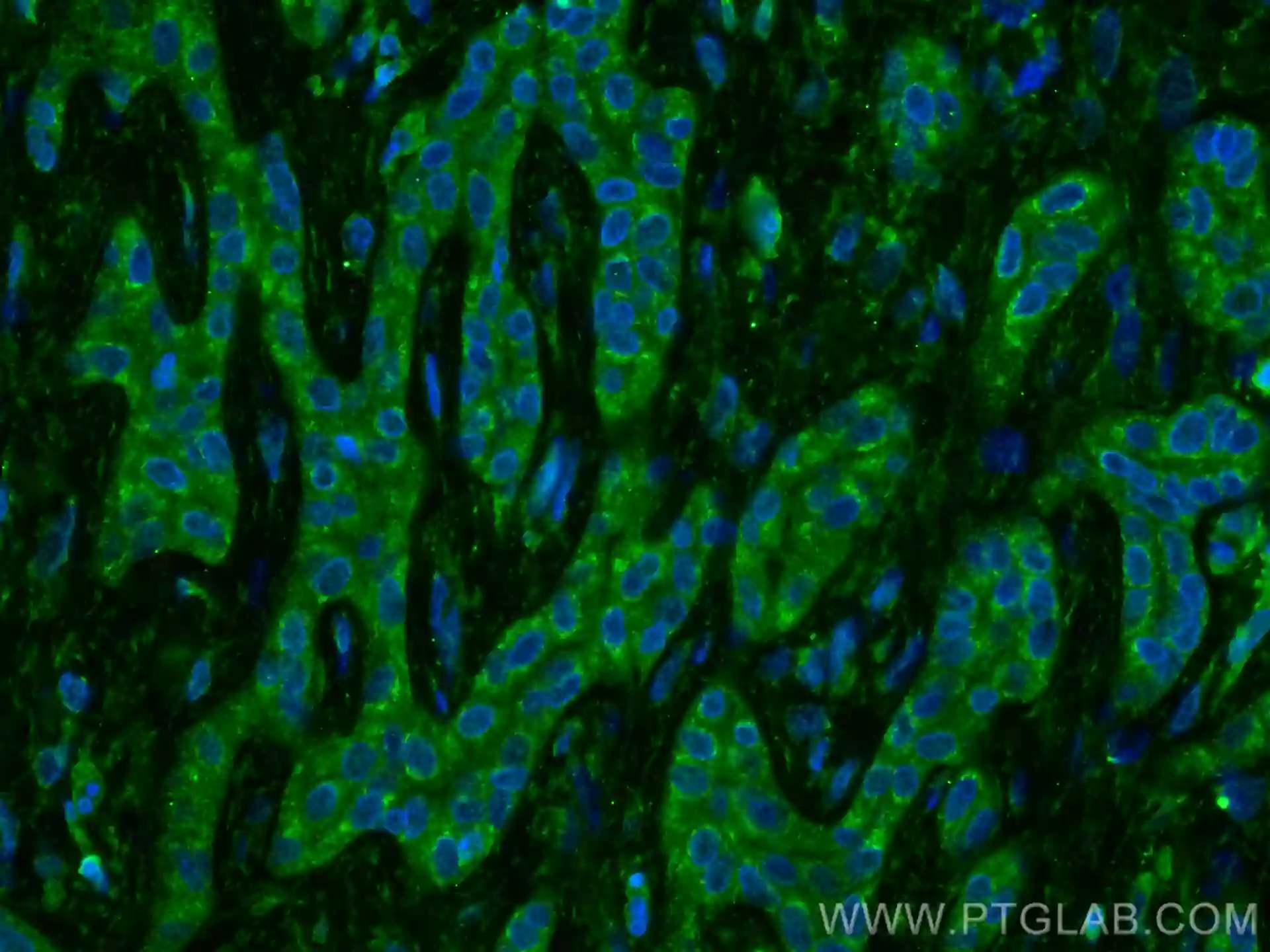 Caspase 4 antibody (67398-1-Ig) | Proteintech