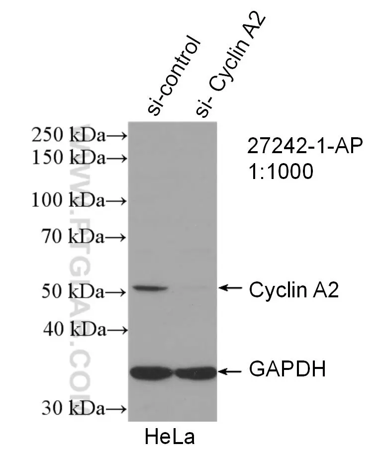 Cyclin A2 antibody (27242-1-AP) | Proteintech