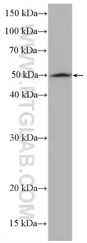 Cyclin A2 antibody (27242-1-AP) | Proteintech