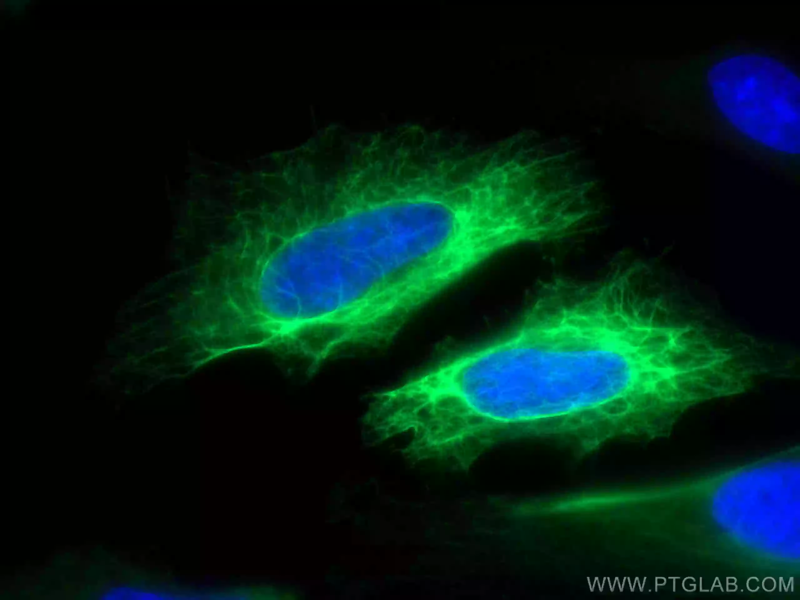 Cytokeratin 19 antibody (CL488-10712) | Proteintech