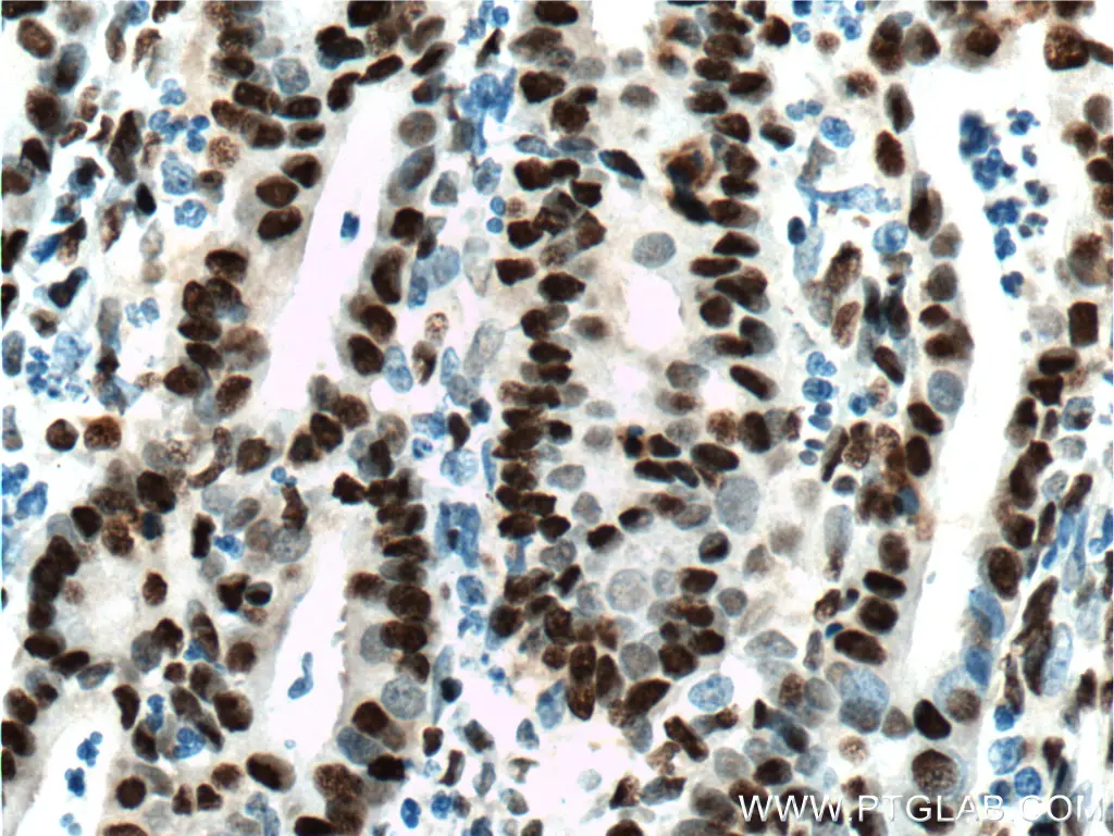 DACH1 antibody (60082-1-Ig) | Proteintech