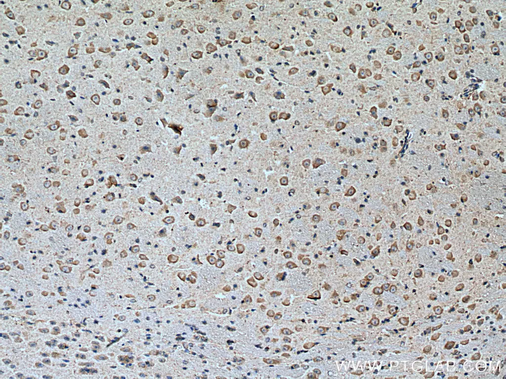 DKK3 antibody (66758-1-Ig) | Proteintech