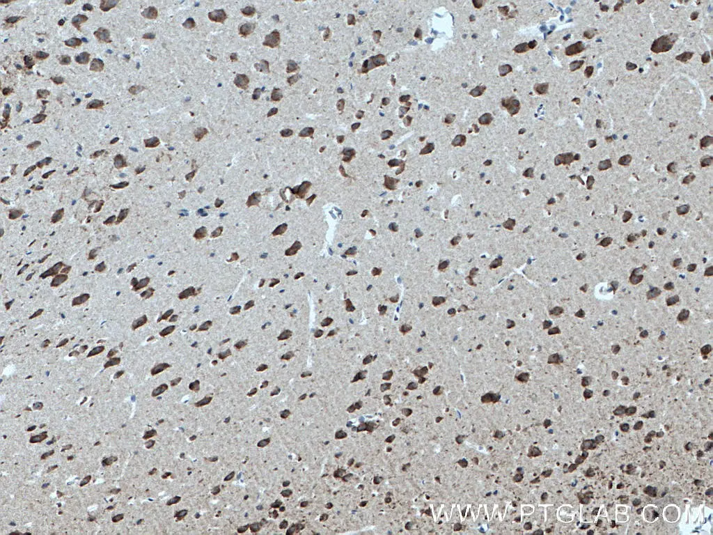 DNAJB6 antibody (66587-1-Ig) | Proteintech