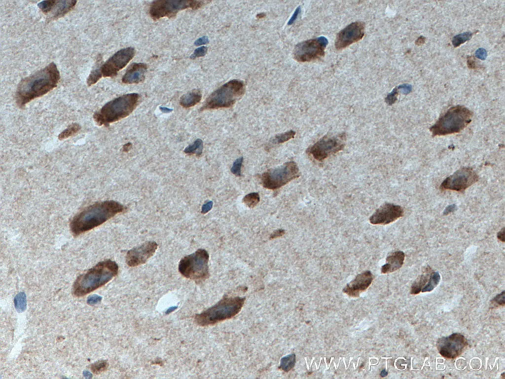 DNAJB6 antibody (66587-1-Ig) | Proteintech