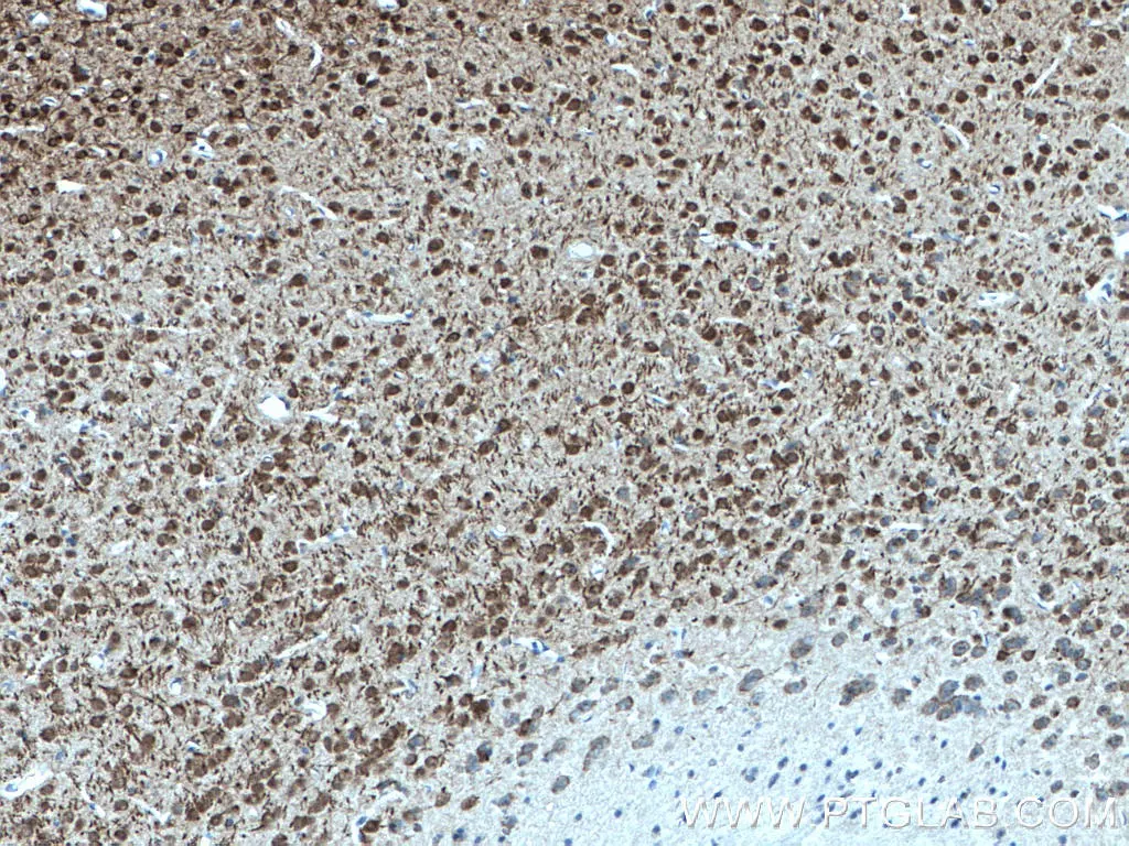 DNAJB6 antibody (66587-1-Ig) | Proteintech