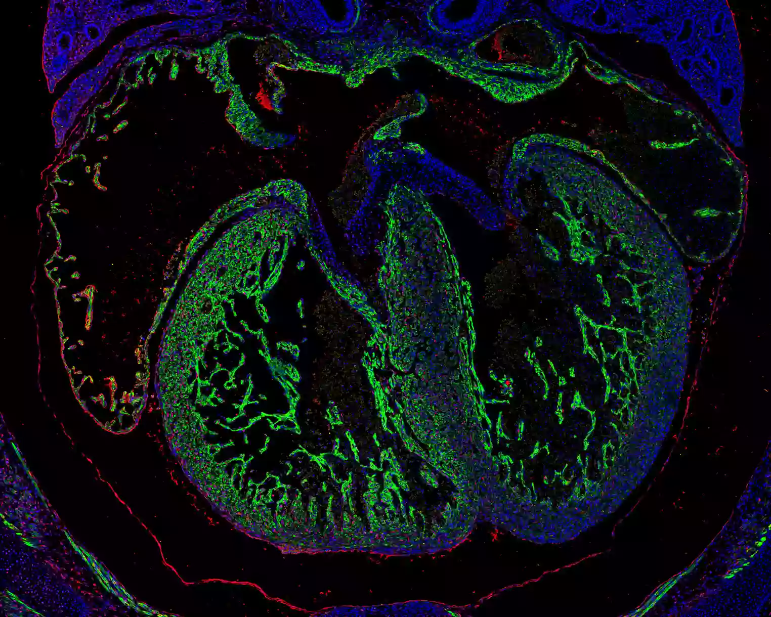 IF Staining of mouse heart using Desmin antibody (CL488-16520)