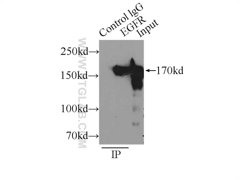 EGFR C terminal antibody 51071 2 AP Proteintech