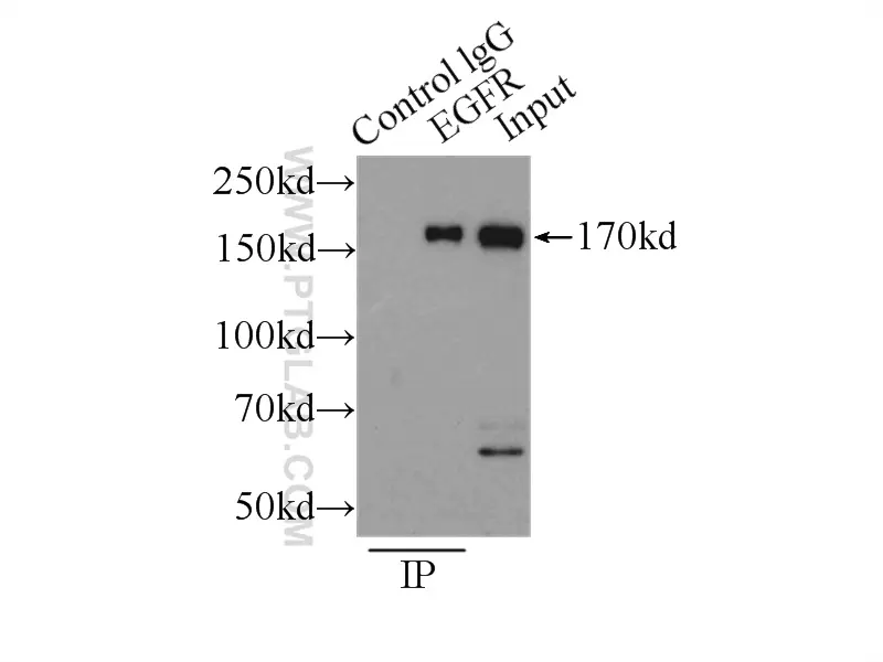 EGFR Specific antibody 18986 1 AP Proteintech