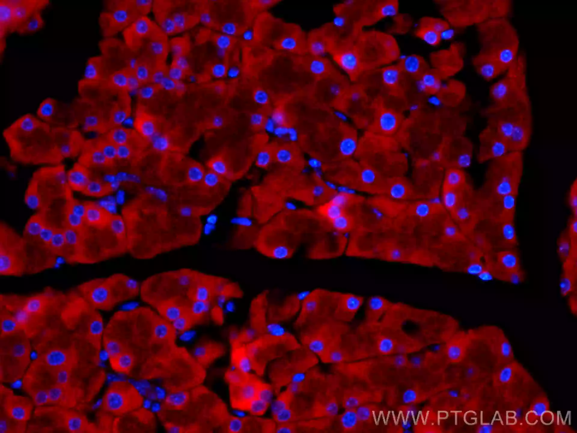 EIF3L antibody (CL594-67719) | Proteintech