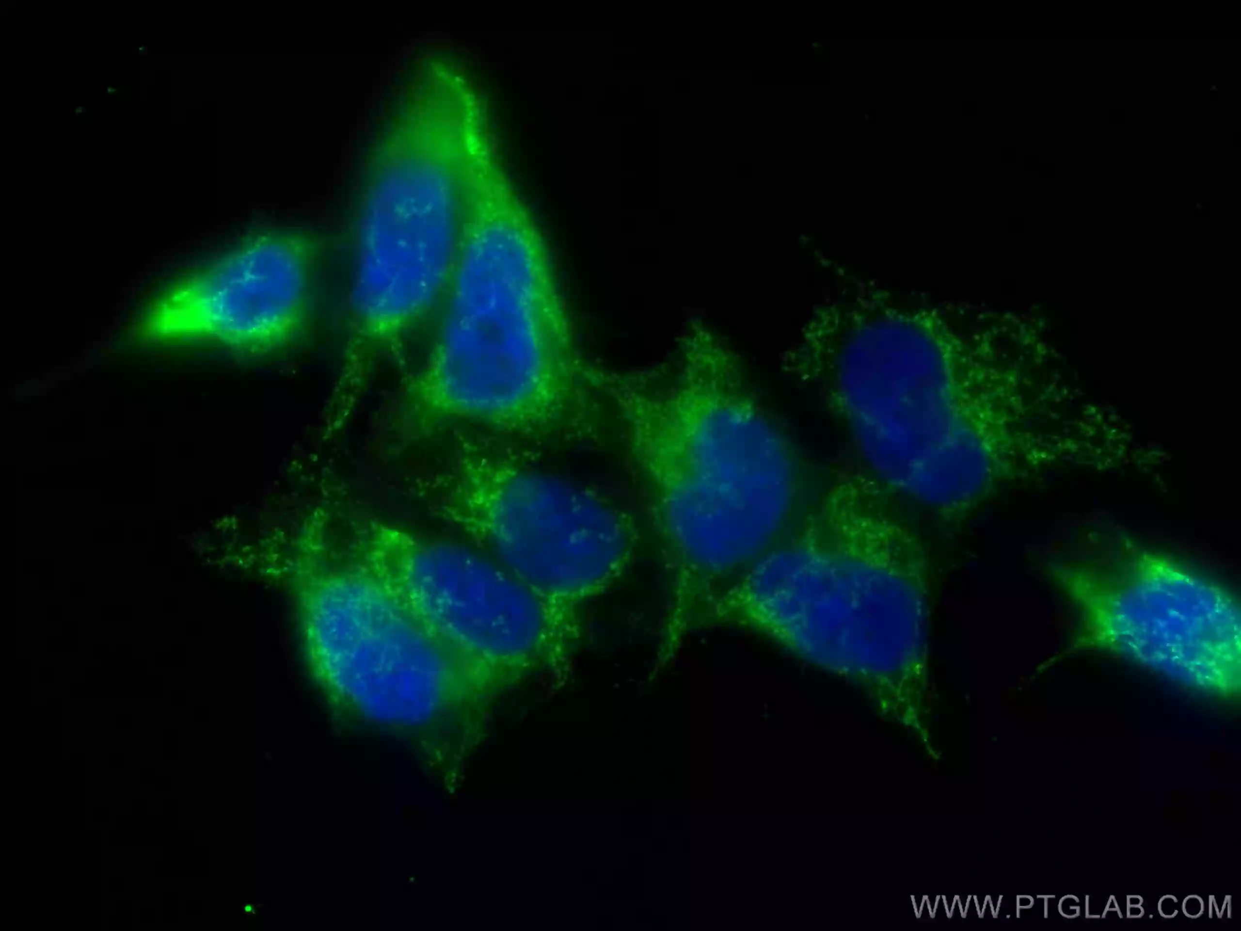 ERO1L antibody (67416-1-Ig) | Proteintech