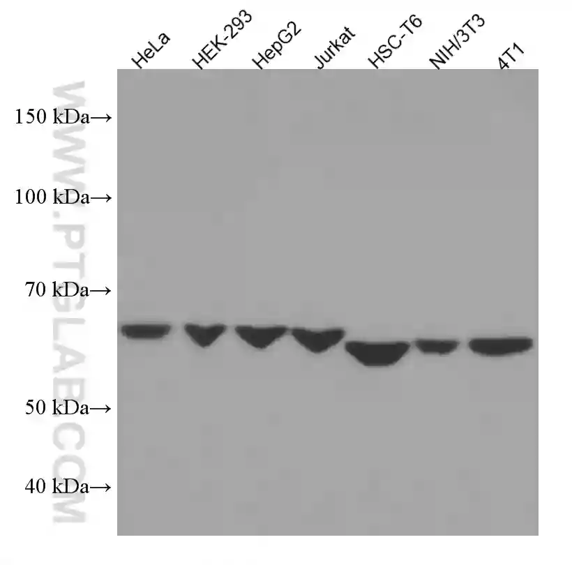 ERO1L antibody (67416-1-Ig) | Proteintech