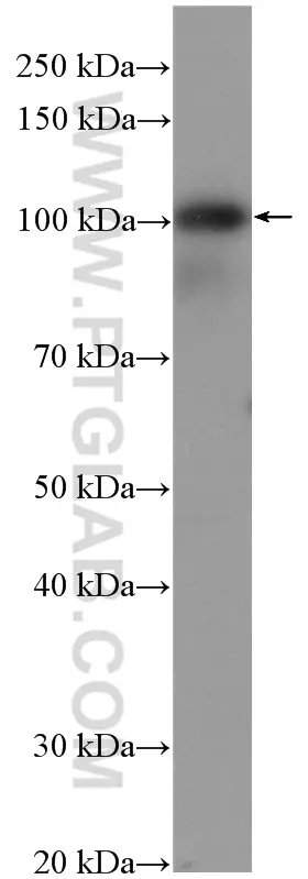 EZH2 antibody (66476-1-Ig) | Proteintech