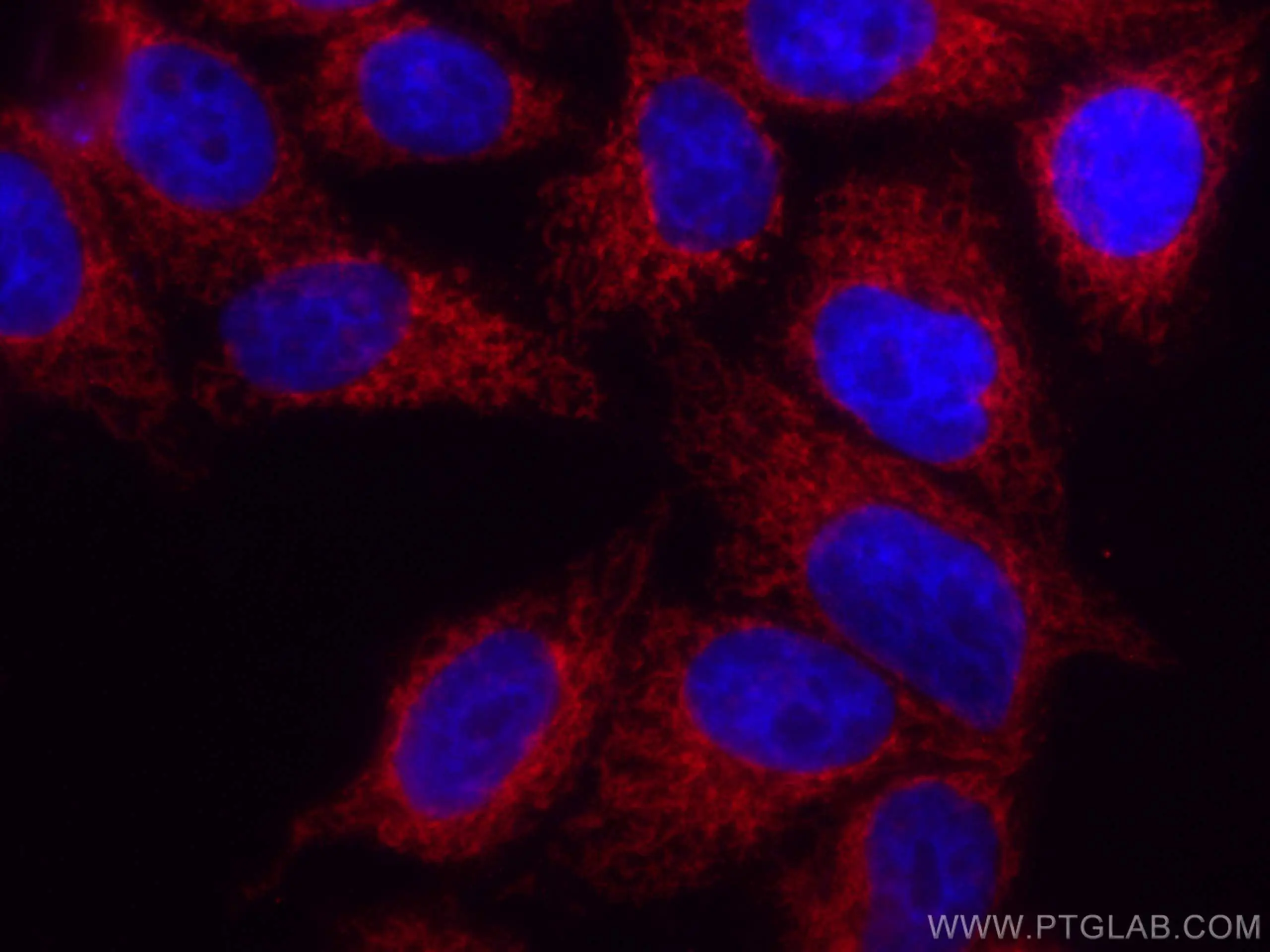 FIS1 antibody (CL594-66635) | Proteintech