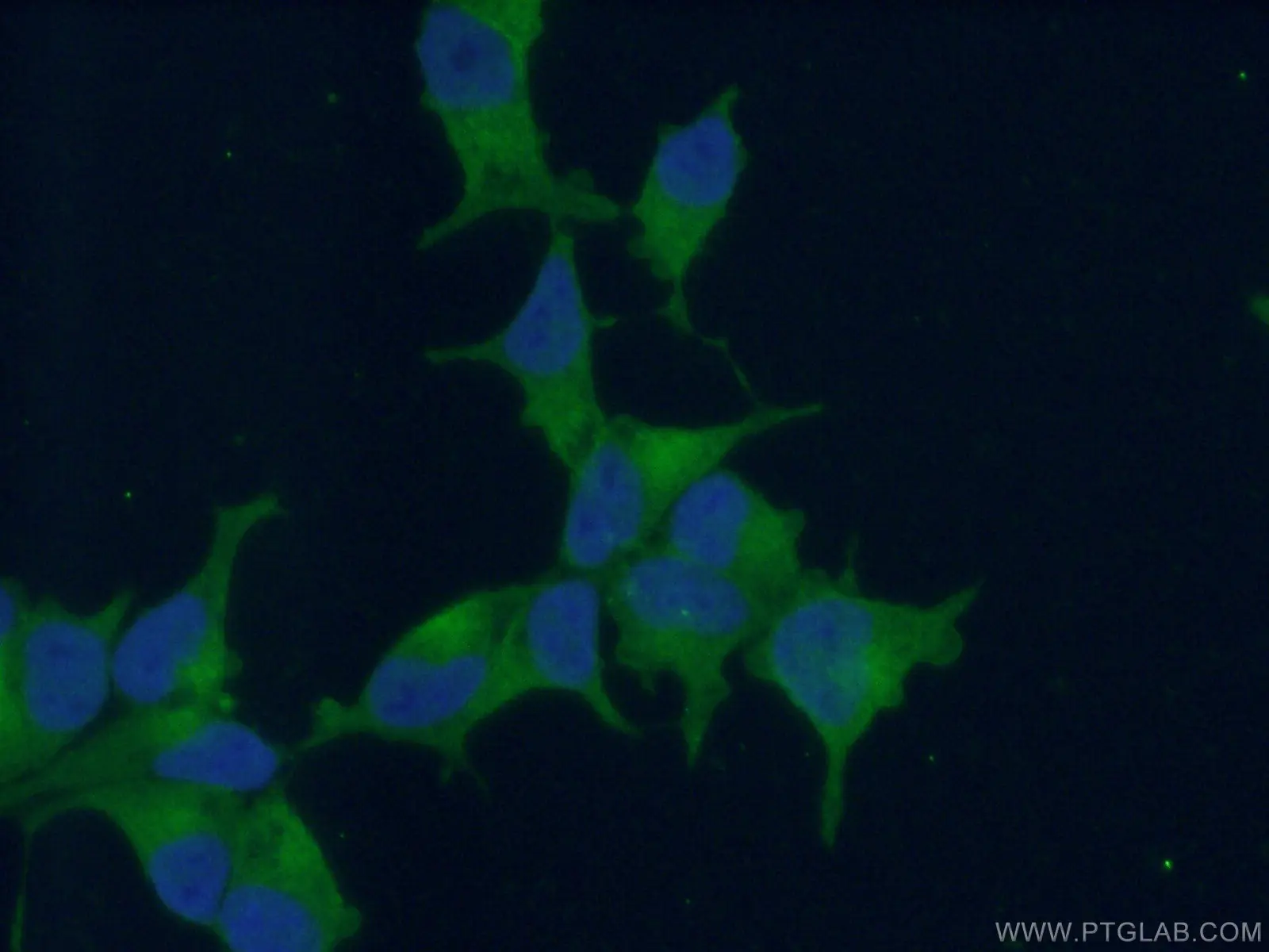 PSMA/GCPII antibody (13163-1-AP) | Proteintech