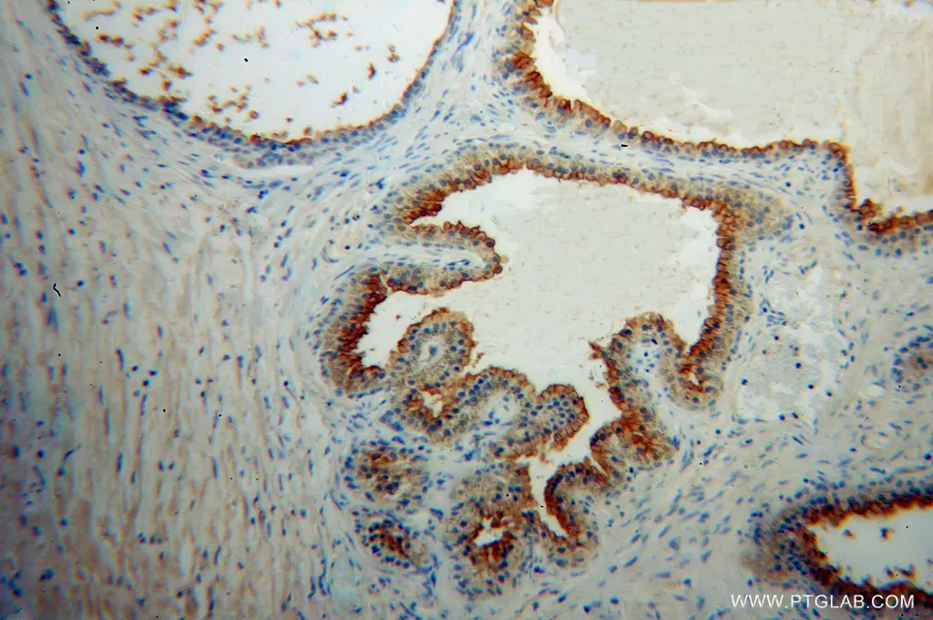 PSMA/GCPII antibody (13163-1-AP) | Proteintech