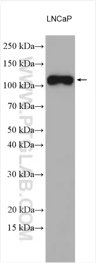 PSMA/GCPII antibody (13163-1-AP) | Proteintech