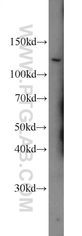 PSMA/GCPII antibody (13163-1-AP) | Proteintech