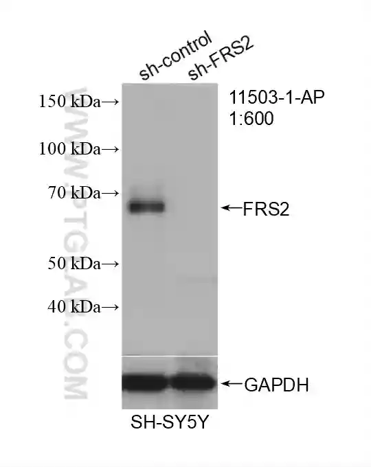 https://www.ptglab.com/products/pictures/webp/FRS2-Antibody-11503-1-AP-WB-463335.webp