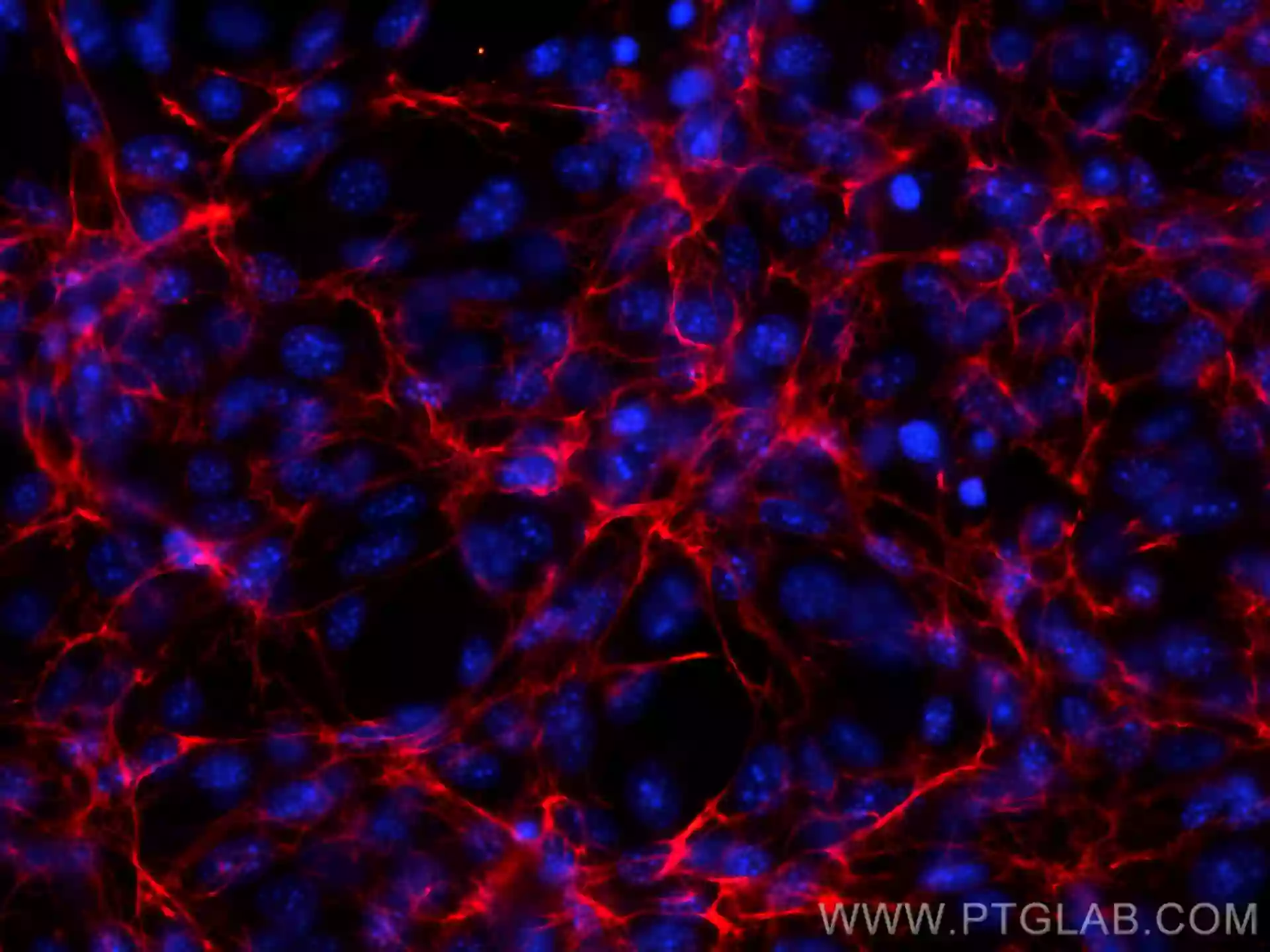 Fibronectin antibody CL594 15613 Proteintech