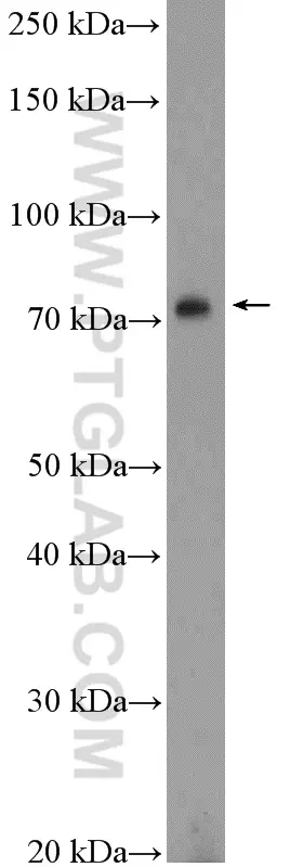 GAS6 antibody (13795-1-AP) | Proteintech