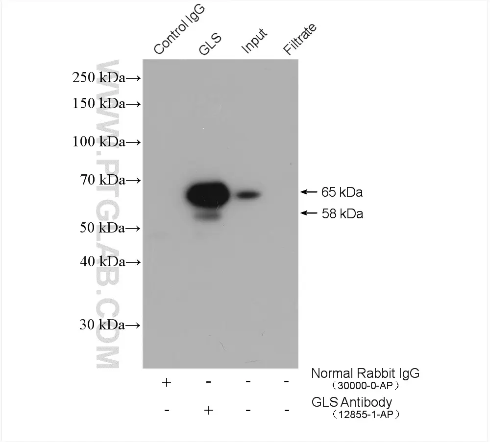KGA/GAC antibody (12855-1-AP) | Proteintech