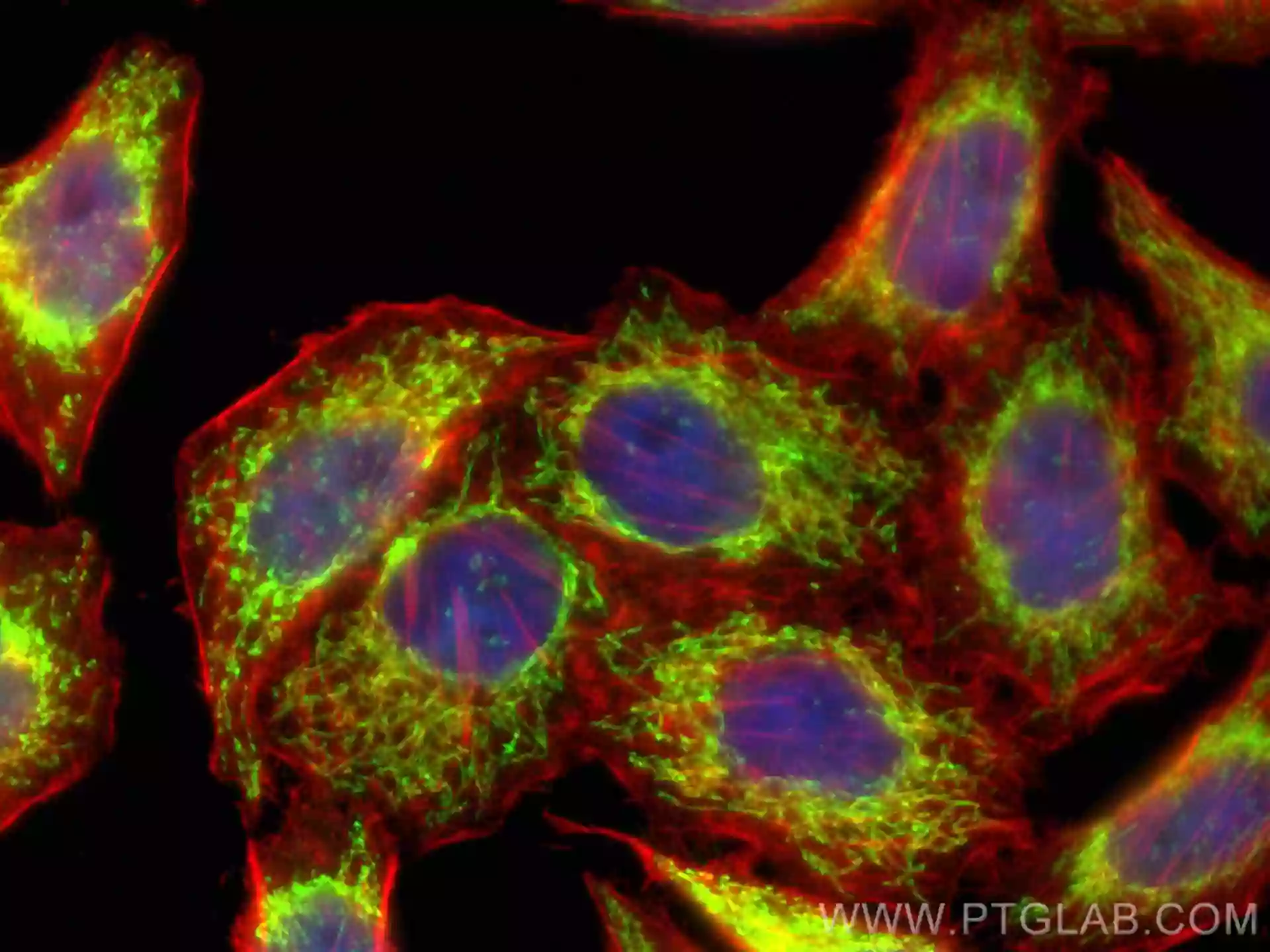 Polyclonal Vs Monoclonal Vs Recombinant Antibodies: What's the Difference?