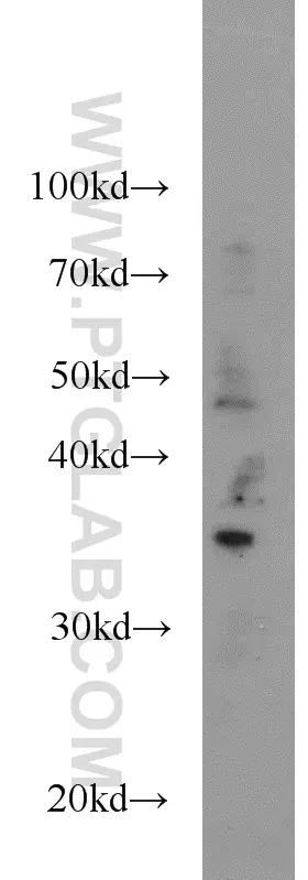 GLYATL1 antibody (15717-1-AP) | Proteintech