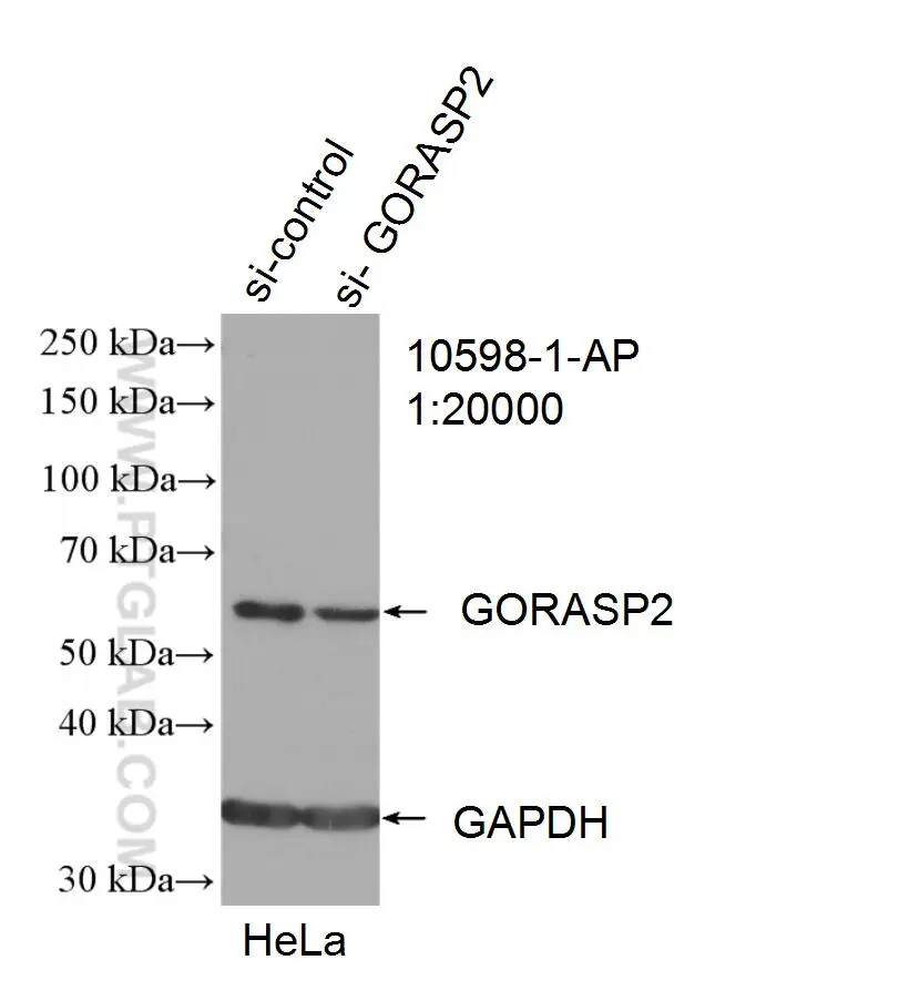 GORASP2 antibody (10598-1-AP) | Proteintech