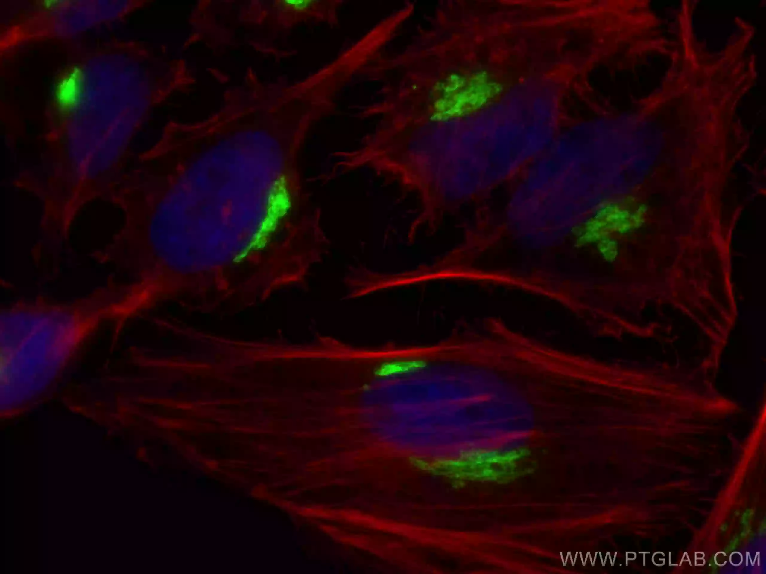 Immunofluorescence staining of HeLa using GP73/GOLPH2 Recombinant antibody
