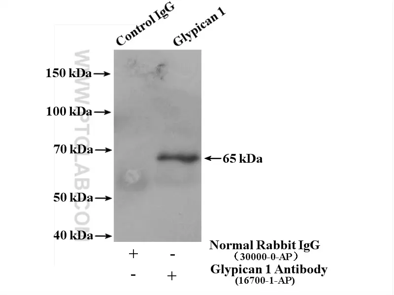 Glypican 1 antibody (16700-1-AP) | Proteintech