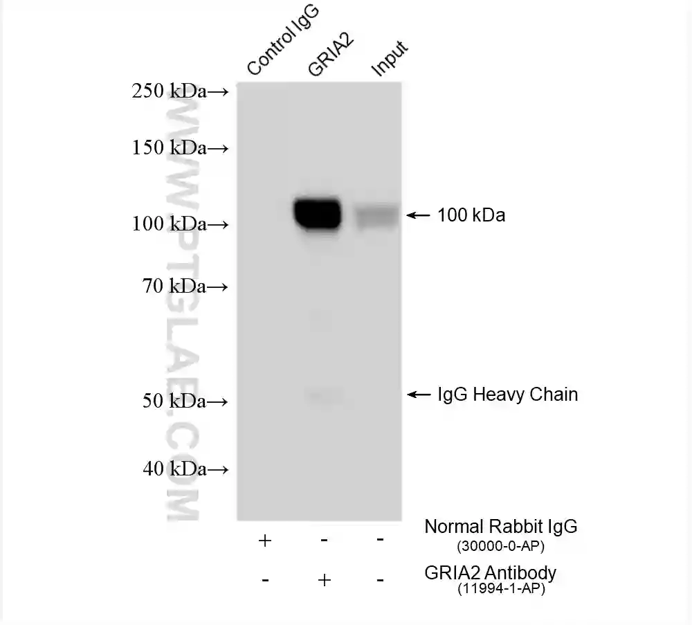 Glutamate receptor 2 antibody (11994-1-AP) | Proteintech