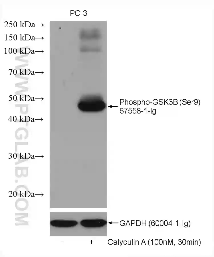 GSK3b （Phospho-Ser9） Antibody 100ul Signalway Antibody aso 86-6674-10 医療・研究  通販