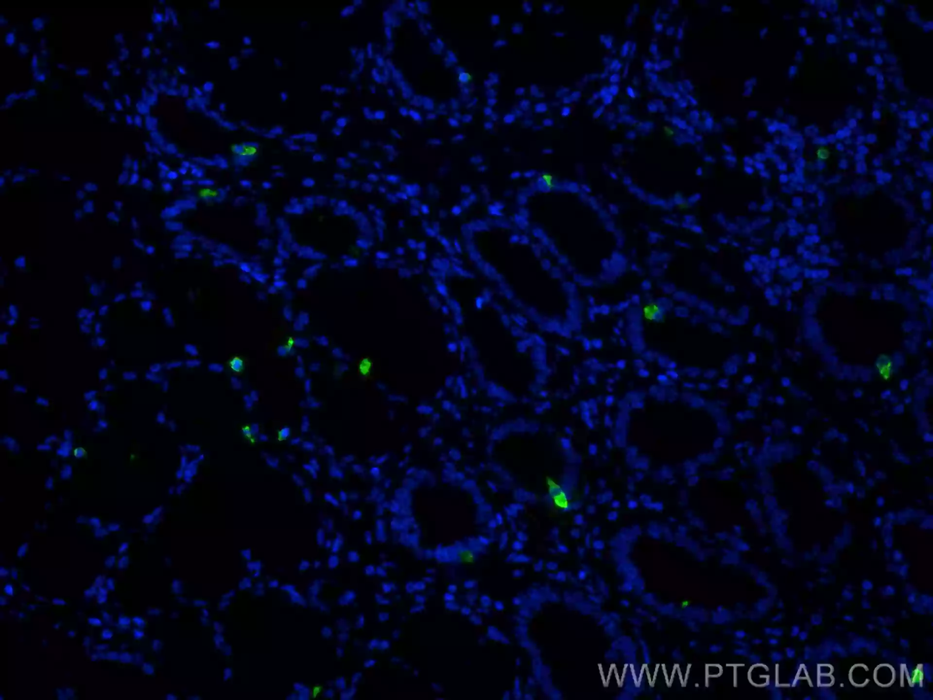 Gastrin antibody (60346-1-Ig) | Proteintech